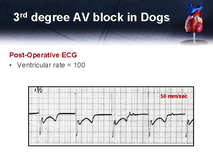 3 rd degree AV block in Dogs Post-Operative ECG • Ventricular rate = 100