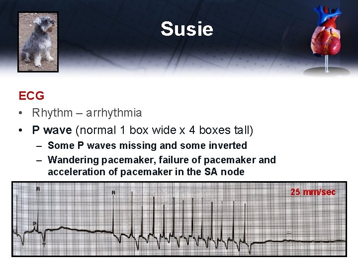 Susie ECG • Rhythm – arrhythmia • P wave (normal 1 box wide x