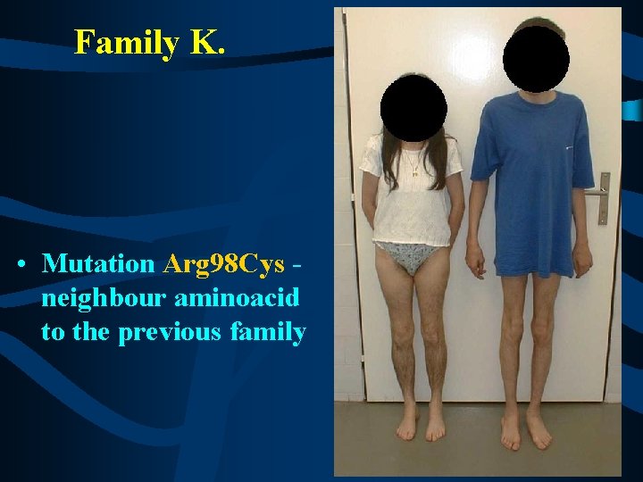 Family K. • Mutation Arg 98 Cys neighbour aminoacid to the previous family 