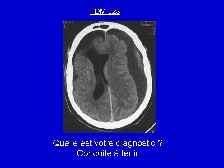 TDM J 23 Quelle est votre diagnostic ? Conduite à tenir 