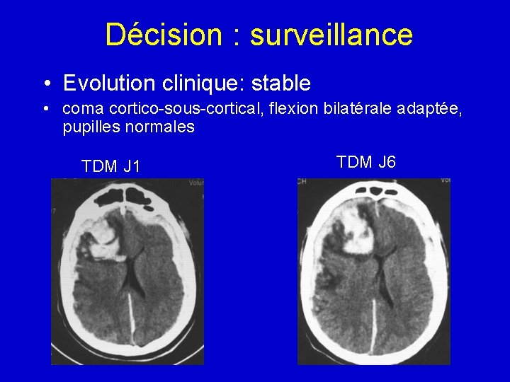 Décision : surveillance • Evolution clinique: stable • coma cortico-sous-cortical, flexion bilatérale adaptée, pupilles