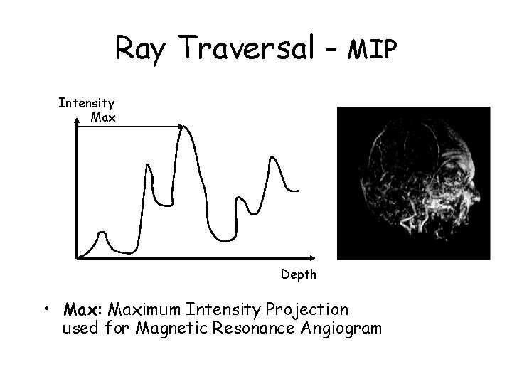 Ray Traversal - MIP Intensity Max Depth • Max: Maximum Intensity Projection used for