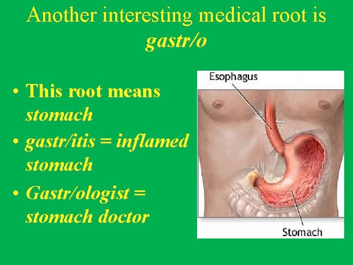 Another interesting medical root is gastr/o • This root means stomach • gastr/itis =