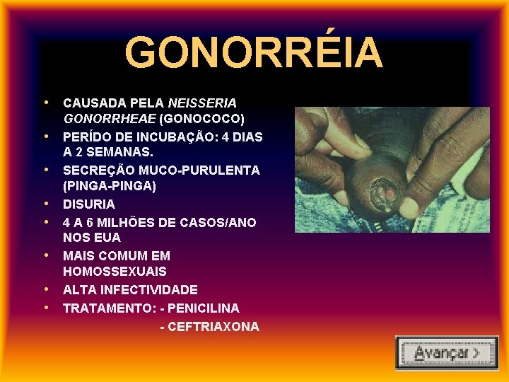 GONORRÉIA • CAUSADA PELA NEISSERIA • • GONORRHEAE (GONOCOCO) PERÍDO DE INCUBAÇÃO: 4 DIAS