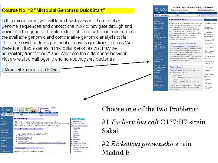 Choose one of the two Problems: #1 Escherichia coli O 157: H 7 strain