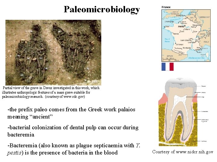 Paleomicrobiology Partial view of the grave in Dreux investigated in this work, which illustrates