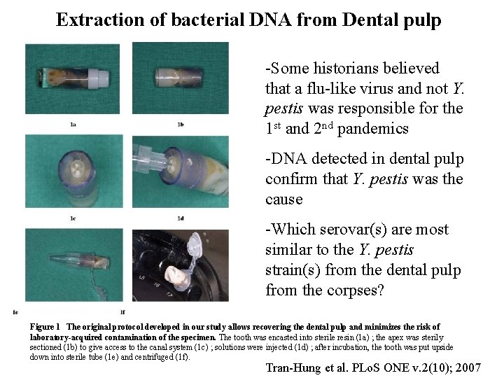 Extraction of bacterial DNA from Dental pulp -Some historians believed that a flu-like virus