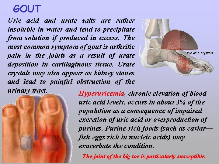 GOUT Uric acid and urate salts are rather insoluble in water and tend to