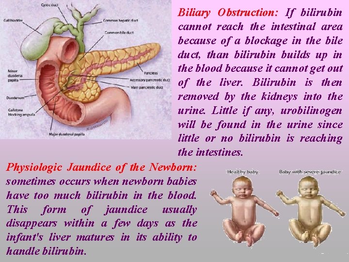 Biliary Obstruction: If bilirubin cannot reach the intestinal area because of a blockage in