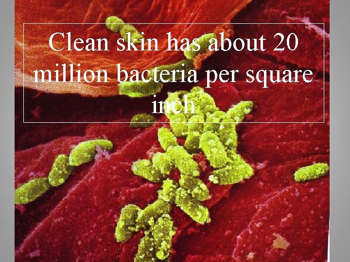 Clean skin has about 20 million bacteria per square inch 14 
