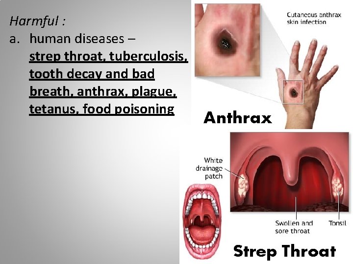 Harmful : a. human diseases – strep throat, tuberculosis, tooth decay and bad breath,