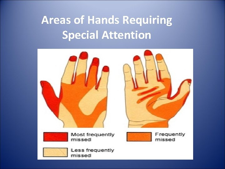 Areas of Hands Requiring Special Attention 