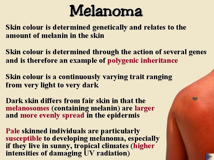 Skin colour is determined genetically and relates to the amount of melanin in the