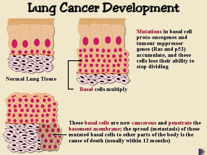 Mutations in basal cell proto-oncogenes and tumour suppressor genes (Ras and p 53) accumulate,