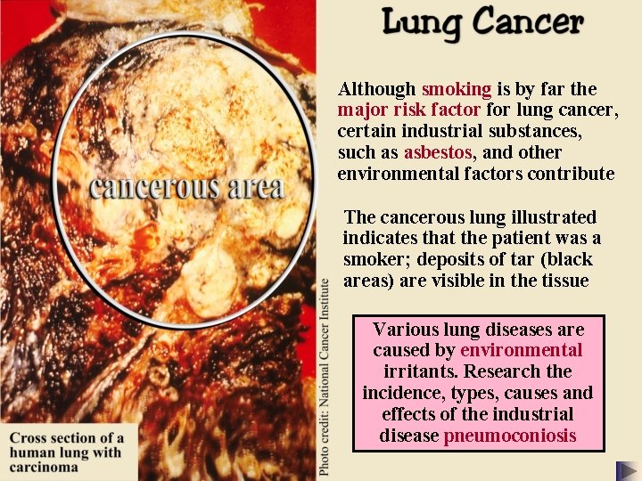 Although smoking is by far the major risk factor for lung cancer, certain industrial