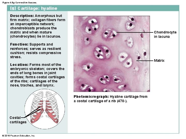 Figure 4. 8 g Connective tissues. Cartilage: hyaline Description: Amorphous but firm matrix; collagen