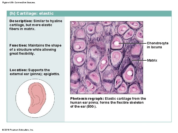 Figure 4. 8 h Connective tissues. Cartilage: elastic Description: Similar to hyaline cartilage, but