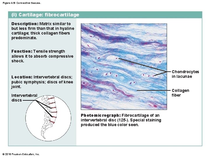 Figure 4. 8 i Connective tissues. Cartilage: fibrocartilage Description: Matrix similar to but less