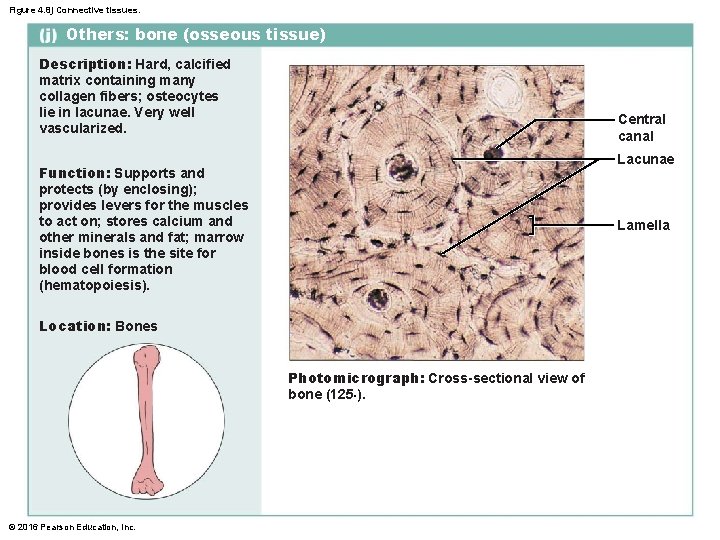 Figure 4. 8 j Connective tissues. Others: bone (osseous tissue) Description: Hard, calcified matrix