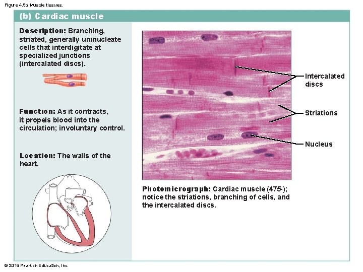 Figure 4. 9 b Muscle tissues. Cardiac muscle Description: Branching, striated, generally uninucleate cells