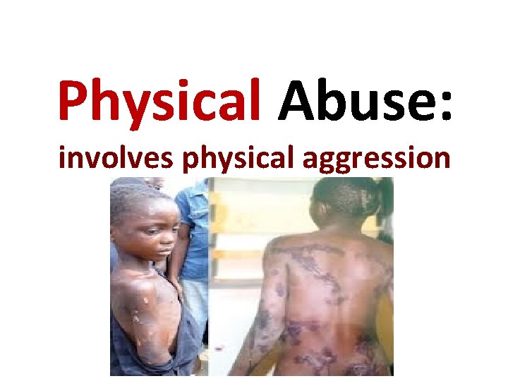 Physical Abuse: involves physical aggression 