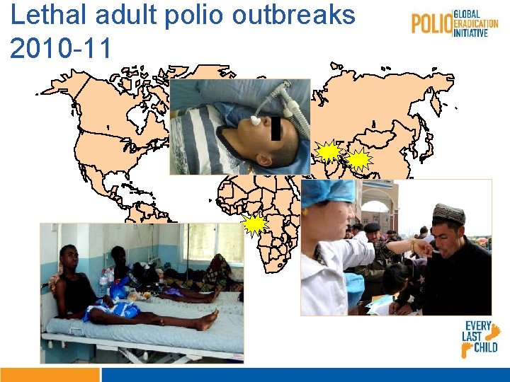 Lethal adult polio outbreaks Recent Polio Outbreaks 2010 -11 
