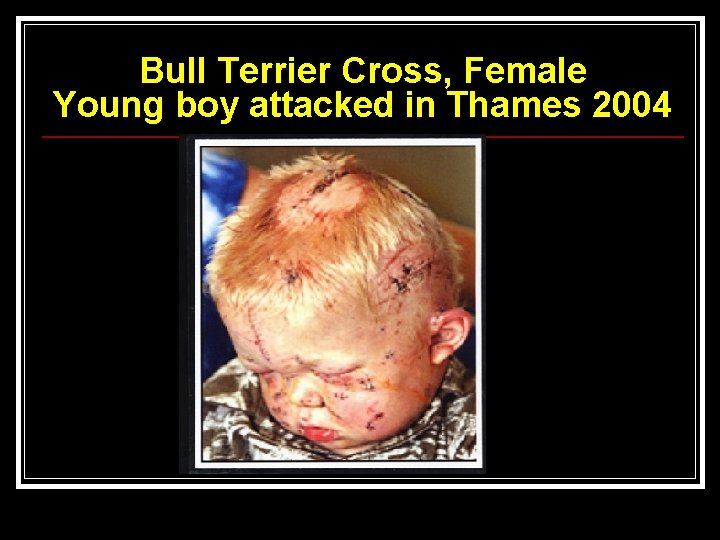 Bull Terrier Cross, Female Young boy attacked in Thames 2004 