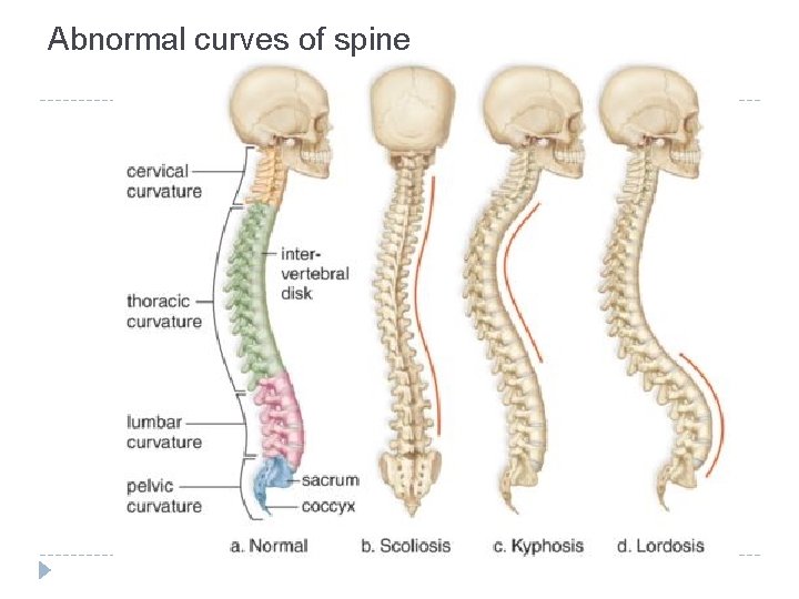 Abnormal curves of spine 