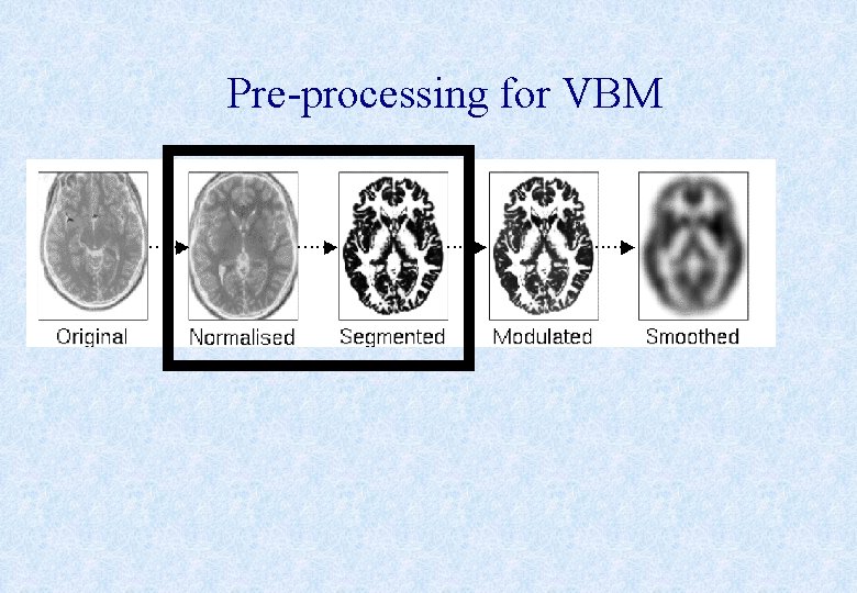 Pre-processing for VBM 