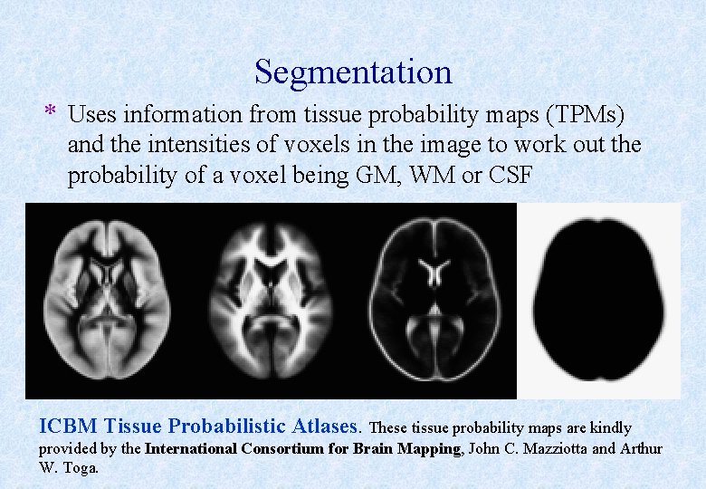 Segmentation * Uses information from tissue probability maps (TPMs) and the intensities of voxels