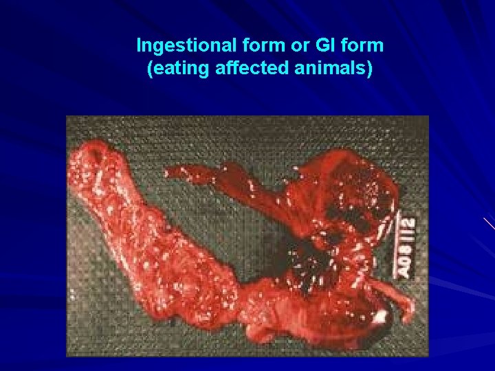 Ingestional form or GI form (eating affected animals) 