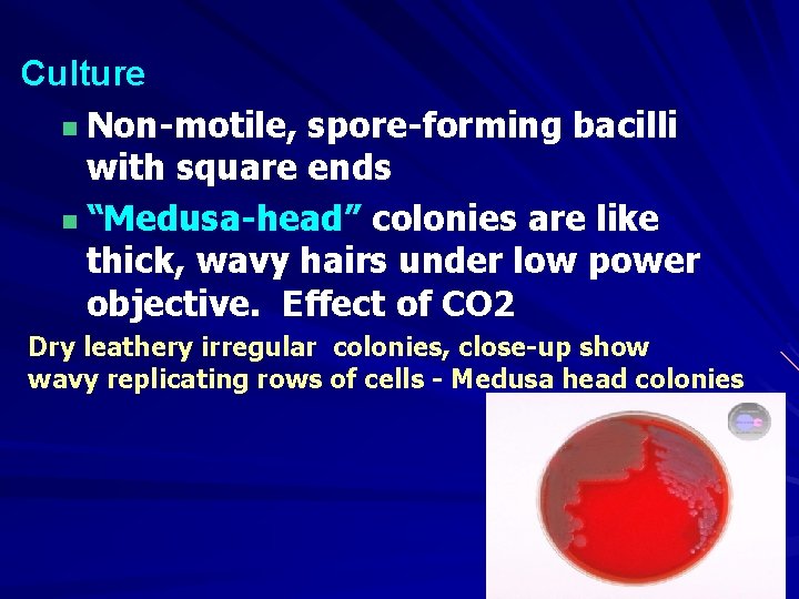 Culture n Non-motile, spore-forming bacilli with square ends n “Medusa-head” colonies are like thick,