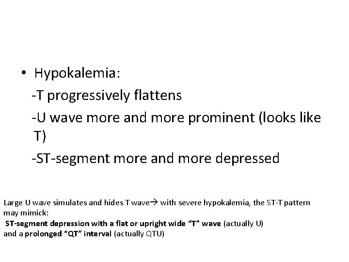  • Hypokalemia: -T progressively flattens -U wave more and more prominent (looks like