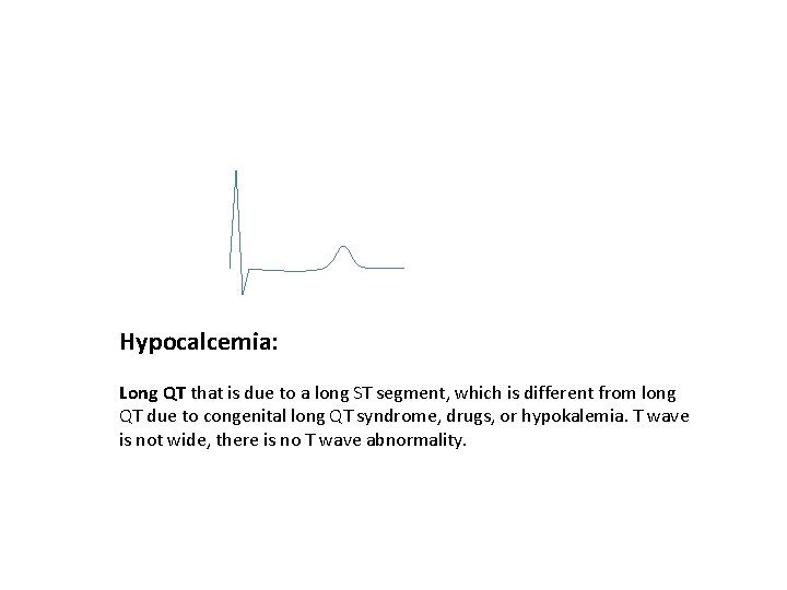 Hypocalcemia: Long QT that is due to a long ST segment, which is different