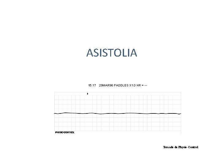 ASISTOLIA 15: 17 29 MAR 96 PADDLES X 1. 0 HR = --- Tomado