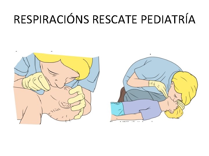 RESPIRACIÓNS RESCATE PEDIATRÍA 