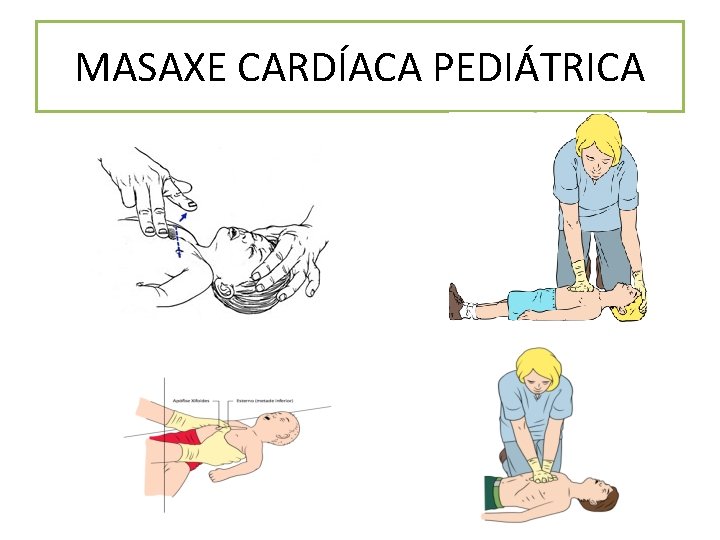 MASAXE CARDÍACA PEDIÁTRICA 