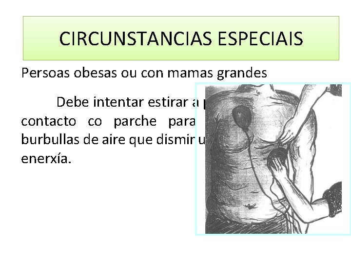 CIRCUNSTANCIAS ESPECIAIS Persoas obesas ou con mamas grandes Debe intentar estirar a pel na