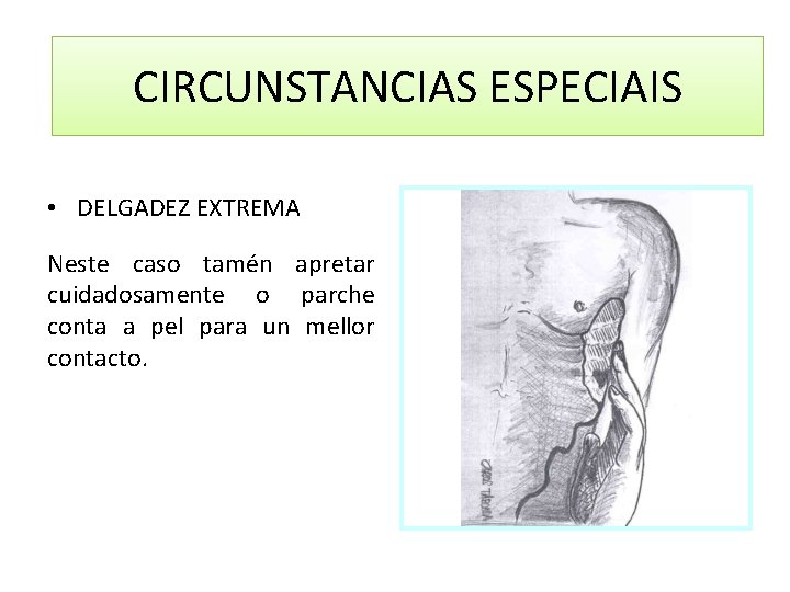 CIRCUNSTANCIAS ESPECIAIS • DELGADEZ EXTREMA Neste caso tamén apretar cuidadosamente o parche conta a