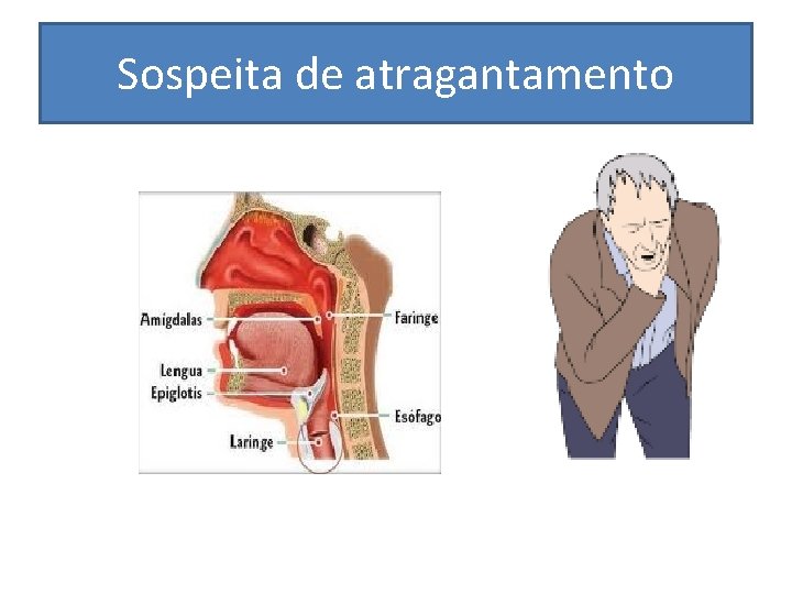 Sospeita de atragantamento 