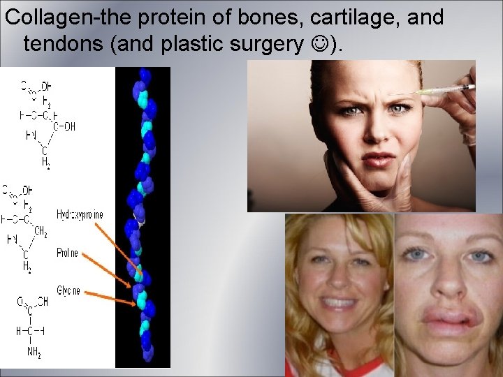 Collagen-the protein of bones, cartilage, and tendons (and plastic surgery ). Figure 2. 17 Collagen-the protein of bones, cartilage, and tendons (and plastic surgery ). Figure 2. 17