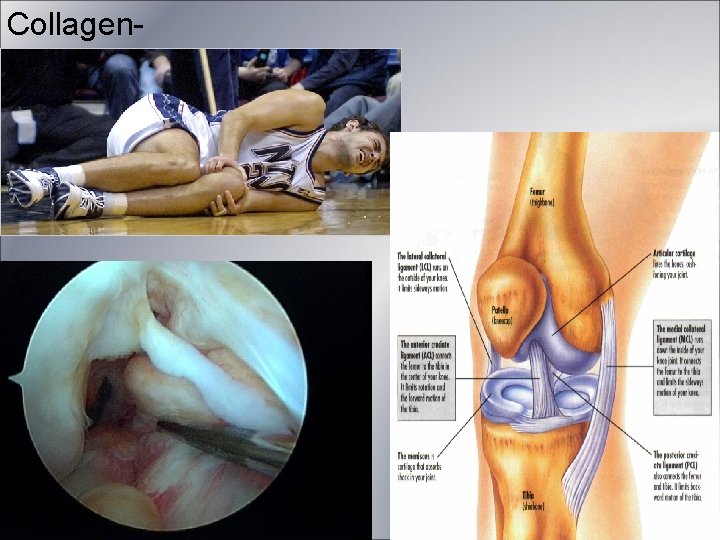 Collagen- Figure 2. 17 a Collagen- Figure 2. 17 a