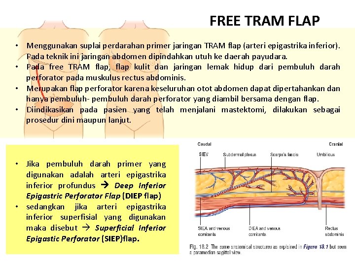 FREE TRAM FLAP • Menggunakan suplai perdarahan primer jaringan TRAM flap (arteri epigastrika inferior).