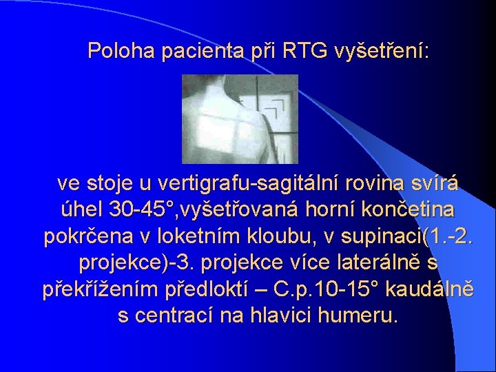 Poloha pacienta při RTG vyšetření: ve stoje u vertigrafu-sagitální rovina svírá úhel 30 -45°,