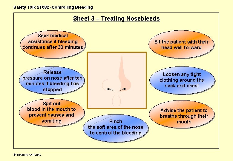 Safety Talk ST 082 -Controlling Bleeding Sheet 3 – Treating Nosebleeds Seek medical assistance