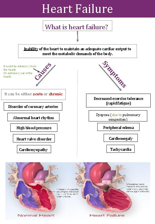 Heart Failure What is heart failure? us Ca s om Disorder of coronary arteries