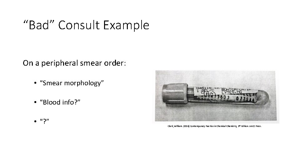 “Bad” Consult Example On a peripheral smear order: • “Smear morphology” • “Blood info?