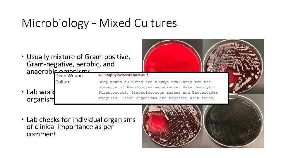 Microbiology – Mixed Cultures • Usually mixture of Gram-positive, Gram-negative, aerobic, and anaerobic organisms