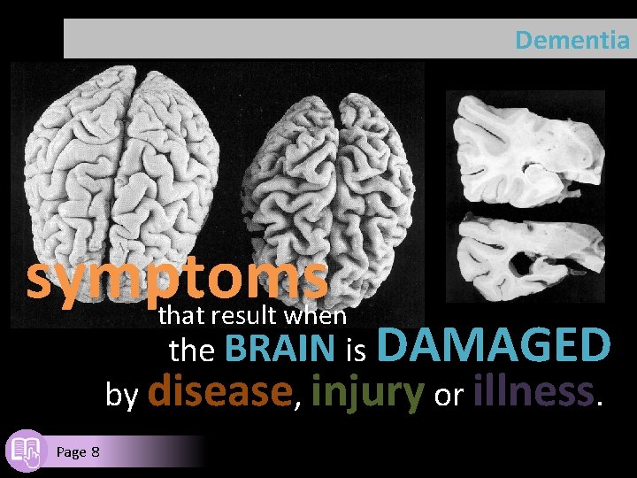 Dementia symptoms that result when the BRAIN is DAMAGED by disease, injury or illness.