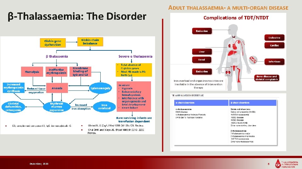 β-Thalassaemia: The Disorder December, 2020 ADULT THALASSAEMIA- A MULTI-ORGAN DISEASE Complications of TDT/NTDT 6